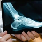 A doctor reviews a foot X-ray on a digital tablet in a medical consultation setting.